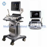 Trolley 3D/4D Color Doppler Ultrasound