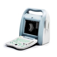 ODU-8 Ophthalmic Portable Ab Scan Ultrasound Machine