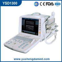 Full Digital Portable Ultrasound Equipment