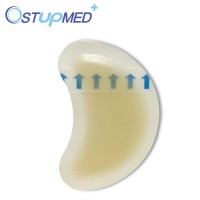 Advanced Sterile Hydrocolloid Dressing for Wound Care