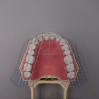 China Dental Guide Plate of Teeth Manufacturer