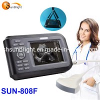 Handheld Medical Digital Portable Medical Multipurpose Ultrasound Scanner