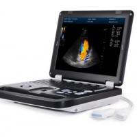 Dcu30 2D  3D  4D Color Doopler Ultrasound Scanner Laptop Design with Internal Battery