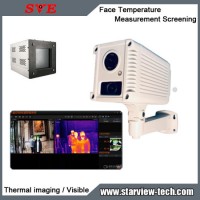 Dual Spectral Thermal Body Temperature Measurement IP Camera System Thermal Temperature Camera