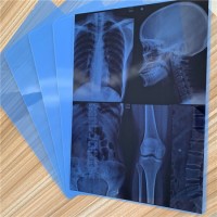 Medical X-ray Film 8*10 Inch