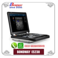 Classic Design  Full Digital 3D/4D Laptop Color Doppler Ultrasonic System  Es230