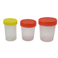 Hospital Disposable 120ml Specimen Collection Urine Container