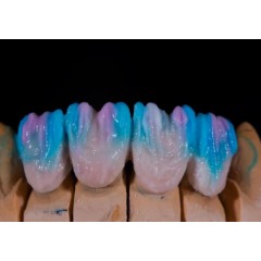 Dental Zirconia Crown From China Dental Lab图1