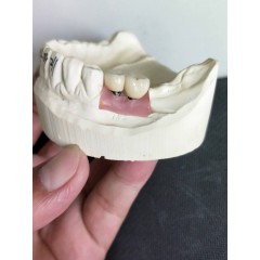 Dental Zirconia Crown From China Dental Lab图3